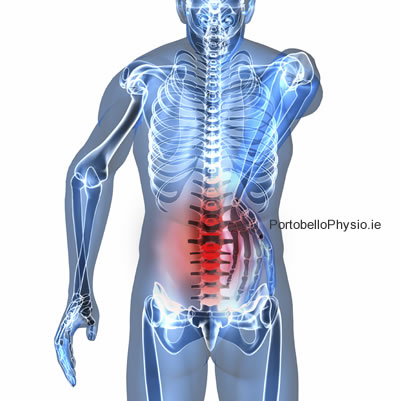 Ankylosing-Spondylitis